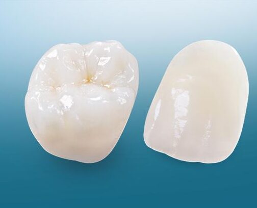 Best Dentist in Dwarka | Best Dentist In Gurgaon | Best Dental Clinic in India | Invisalign Treatment in Gurgaon | Dental Implants Treatment in Gurgaon | Root Canal Treatment in Gurgaon | Invisible Braces in Gurgaon | Denture Treatment in Gurgaon | Crowns & Bridges Treatment in Gurgaon | Kids Dentist in Gurgaon | Teeth Whitening in Gurgaon | Braces in Gurgaon | Buck Teeth Treatment in Gurgaon | My Dental Centre