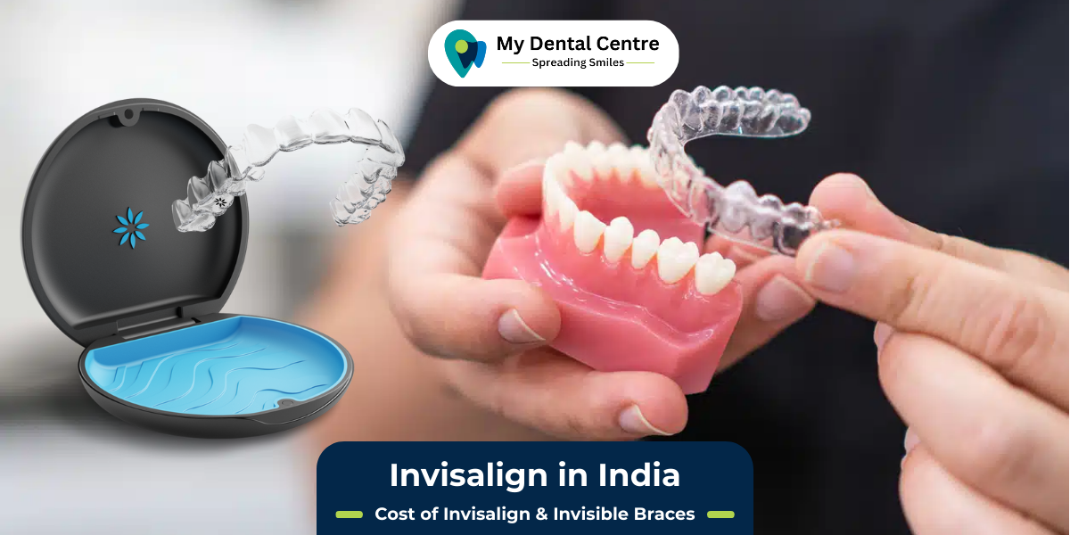 Invisalign in India Cost of Invisalign & Invisible Braces My Dental Centre