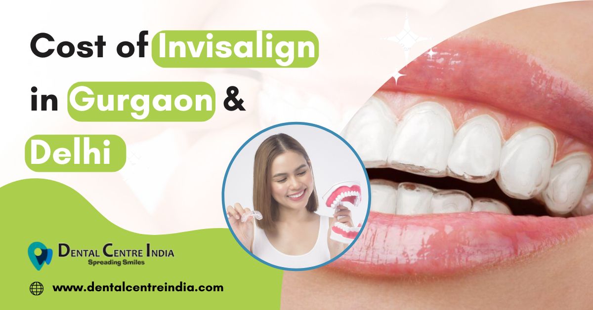 You are currently viewing Invisalign in Gurgaon | Cost  of  Invisalign in Gurgaon & Delhi