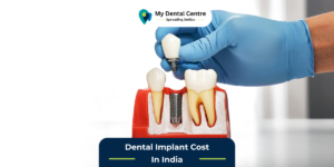 Dental Implant Cost In India My Dental Centre