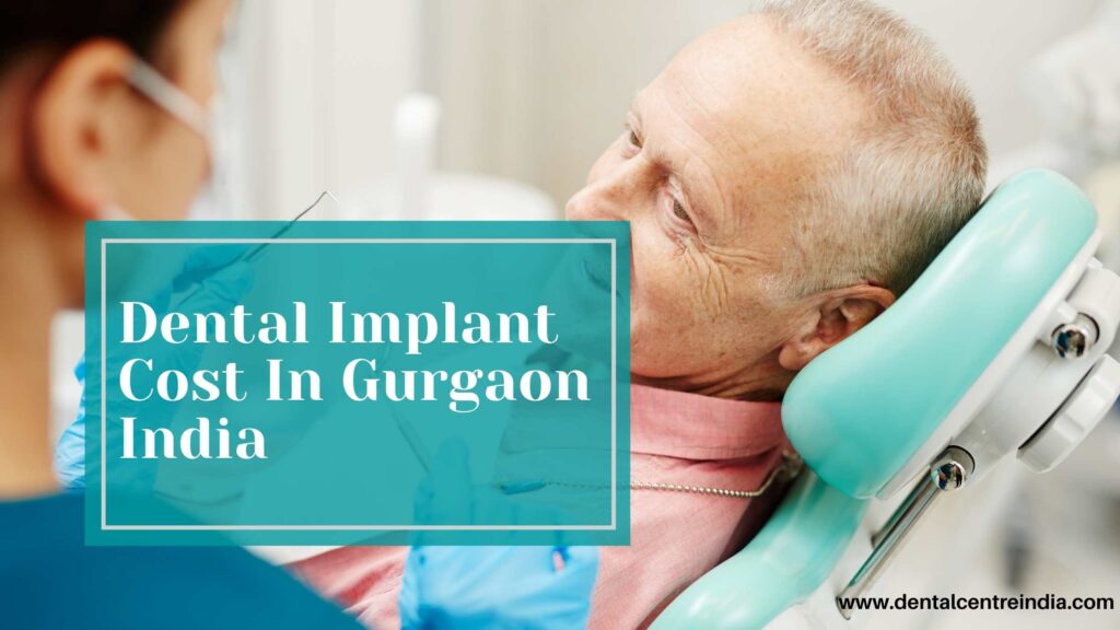 Dental-Implant-Cost-in-gurgaon