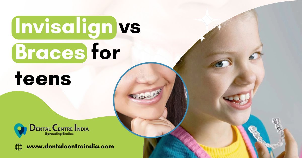 You are currently viewing Invisalign vs Braces for teens