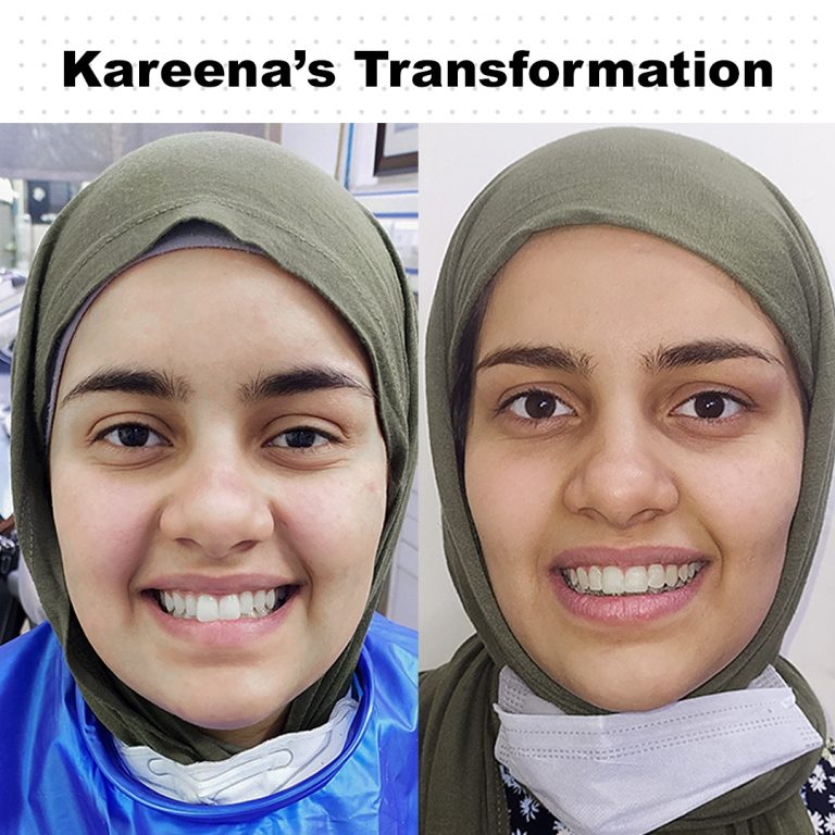 Best Dentist in Dwarka | Best Dentist In Gurgaon | Best Dental Clinic in India | Invisalign Treatment in Gurgaon | Dental Implants Treatment in Gurgaon | Root Canal Treatment in Gurgaon | Invisible Braces in Gurgaon | Denture Treatment in Gurgaon | Crowns & Bridges Treatment in Gurgaon | Kids Dentist in Gurgaon | Teeth Whitening in Gurgaon | Braces in Gurgaon | Buck Teeth Treatment in Gurgaon