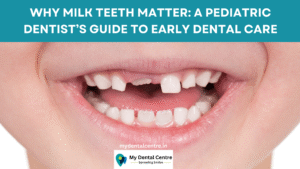 Read more about the article Why Milk Teeth Matter: A Pediatric Dentist’s Guide to Early Dental Care