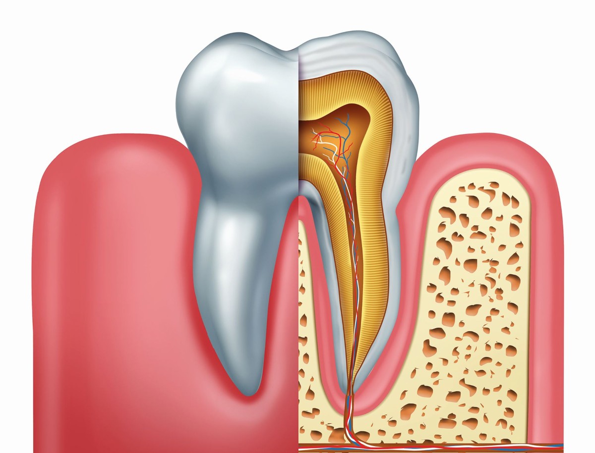 Painless-RCT-treatment-in-gurgaon | Best Dentist in Dwarka | Best Dentist In Gurgaon | Best Dental Clinic in India | Invisalign Treatment in Gurgaon | Dental Implants Treatment in Gurgaon | Root Canal Treatment in Gurgaon | Invisible Braces in Gurgaon | Denture Treatment in Gurgaon | Crowns & Bridges Treatment in Gurgaon | Kids Dentist in Gurgaon | Teeth Whitening in Gurgaon | Braces in Gurgaon | Buck Teeth Treatment in Gurgaon | My Dental Centre