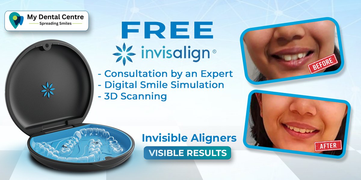 Invisalign Website Banner Mobile