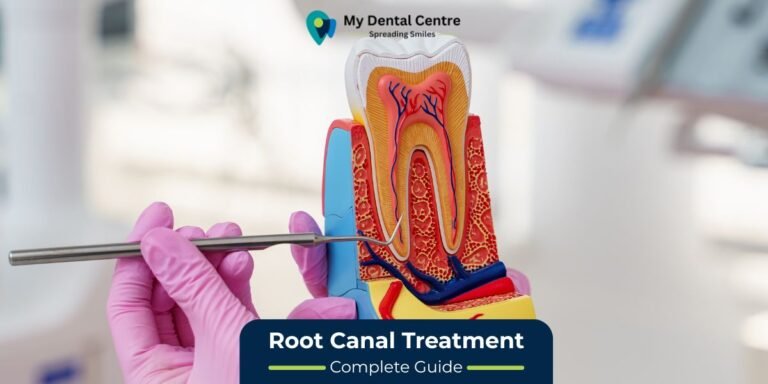 Root Canal Treatment (RCT) Guide: Symptoms,Procedure,Benefits