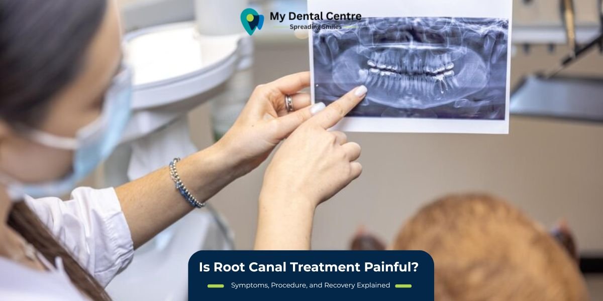 Is Root Canal Treatment Painful? Symptoms, Procedure, Recovery