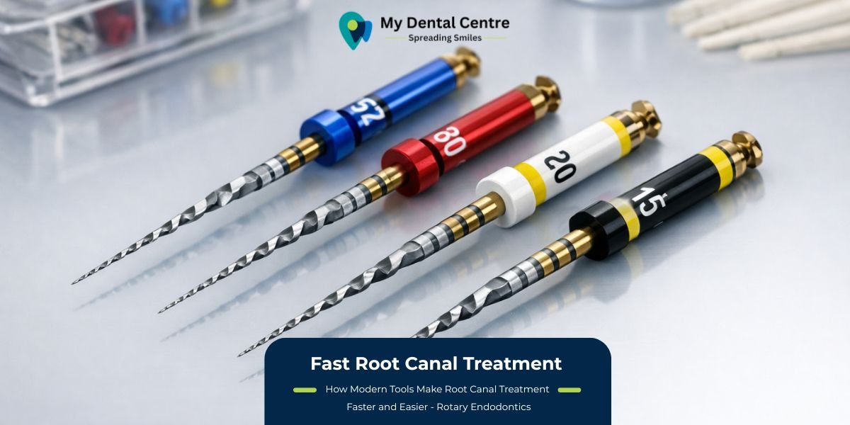 Fast Root Canal Treatment | How Modern Tools Make RCT Faster