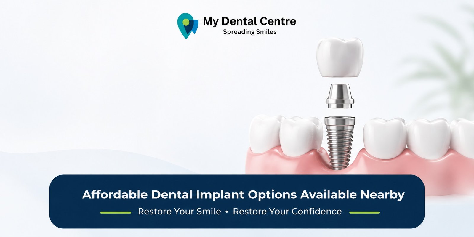 Best Dental Clinic in Gurugram | Best Dentist in Gurugram | Best Dental Clinic in Dwarka | Best Dentist in Dwarka | Dentist Near Me | Dental Clinic Near Me | My Dental Centre | Dental Implants Treatment Near Me
